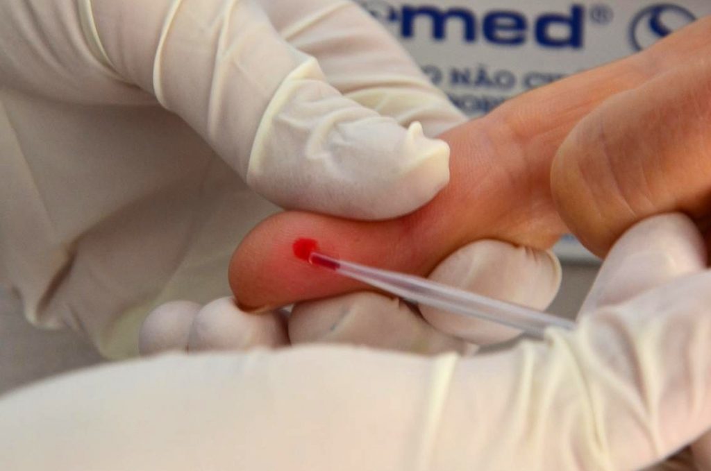 Número de pacientes com hepatite cresce 20% em 10 anos no Brasil