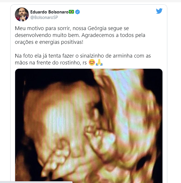 Eduardo Bolsonaro posta ultrassom da filha e brinca: "já tenta fazer arminha"
