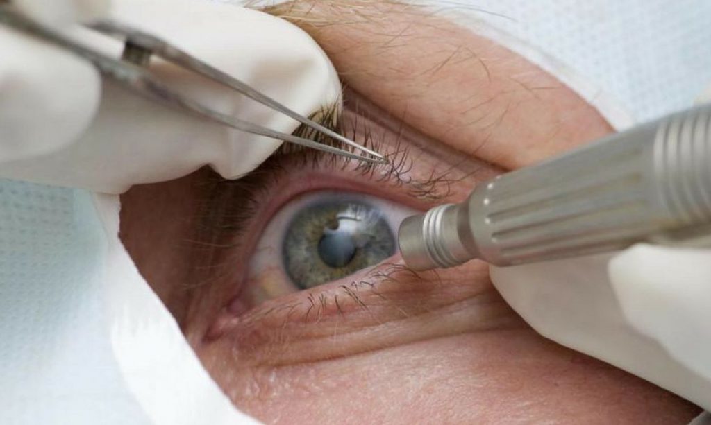 Pandemia da Covid-19 faz cair detecção precoce de glaucoma